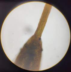 Herzogiella seligeri