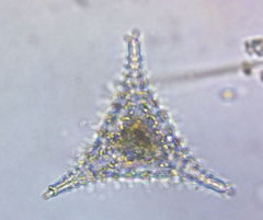 Staurastrum anatinum