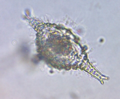 Staurastrum anatinum