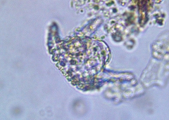 Staurastrum cerastes