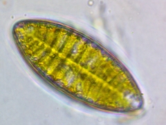 Surirella