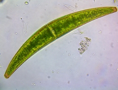 Closterium costatum
