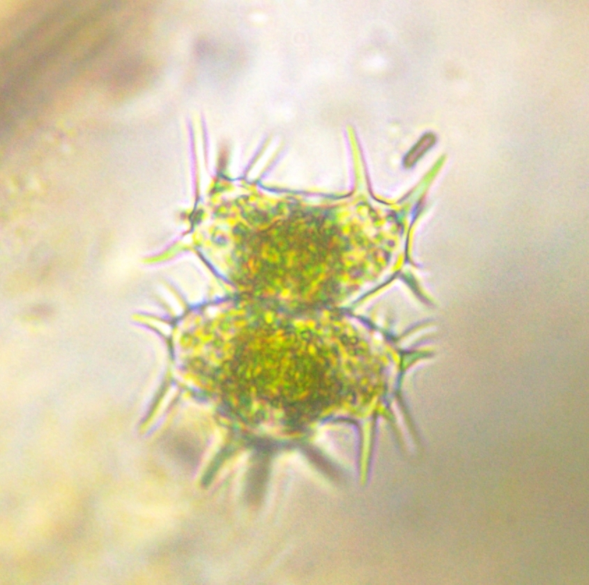 Staurastrum hystrix