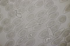 Milesina kriegeriana