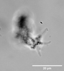 Amoebozoa