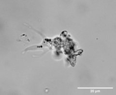 Amoebozoa