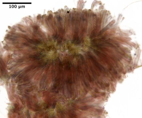 Pseudosclerococcum golindoi