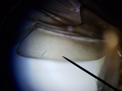 Ocyptamus antiphates