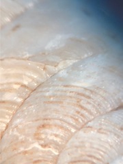 Ventridens intertextus