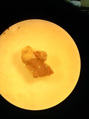 Gastropoda