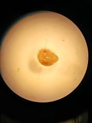 Gastropoda