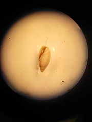 Gastropoda