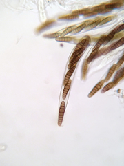 Oedohysterium sinense