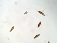 Oedohysterium sinense