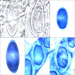 Pertusaria werneriana