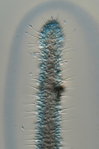 Ophiocordyceps sp. (Hirsutelloid)