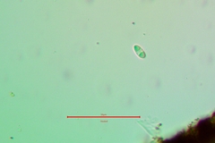 Caloplaca californica