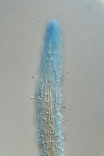 Ophiocordyceps sp. (Hirsutelloid)