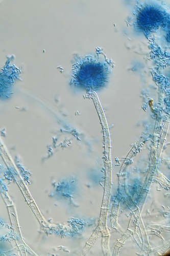 Gibellula sp.