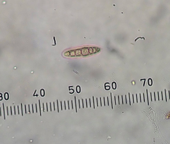 Opegrapha agelaeoides