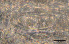 Pertusaria pustulata