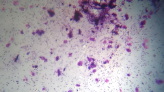 Staphylococcus aureus