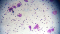 Staphylococcus aureus