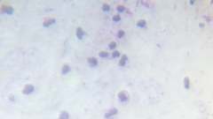 Staphylococcus aureus