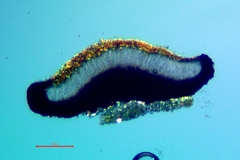 Cresponea chloroconia