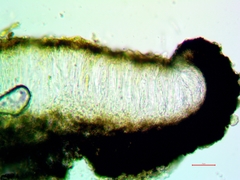Cresponea chloroconia