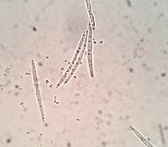 Arachnopeziza delicatula