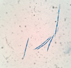 Arachnopeziza delicatula