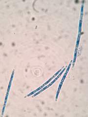 Arachnopeziza delicatula