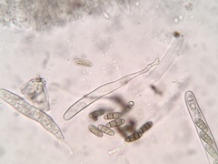 Hysterium hyalinum