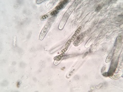 Hysterium hyalinum