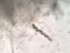 Hysterium hyalinum
