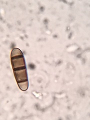 Hysterium hyalinum