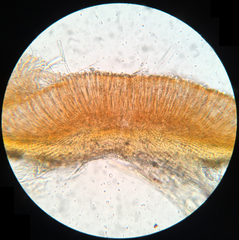 Arachnopeziza trabinelloides