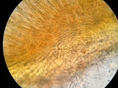 Arachnopeziza trabinelloides