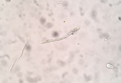 Arachnopeziza trabinelloides