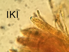 Arachnopeziza trabinelloides