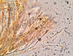 Arachnopeziza trabinelloides