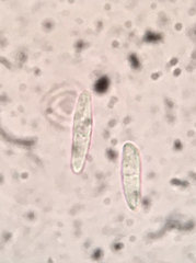 Arachnopeziza trabinelloides