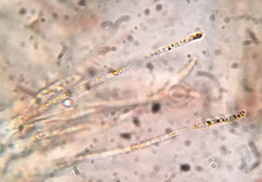 Arachnopeziza trabinelloides