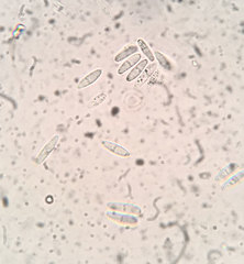 Arachnopeziza trabinelloides