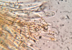 Arachnopeziza trabinelloides