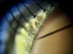 Oxysarcodexia ventricosa