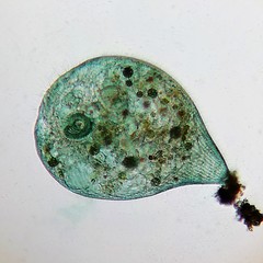 Stentor coeruleus
