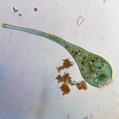 Stentor coeruleus