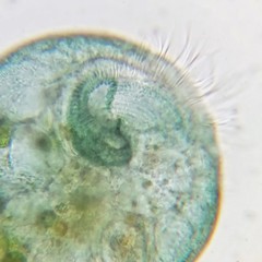 Stentor coeruleus